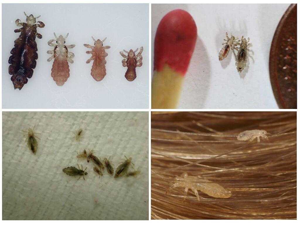 Какие паразиты могут жить в волосах человека кроме вшей