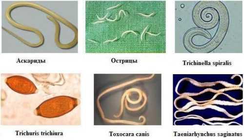 Какие паразиты живут в организме человека фото