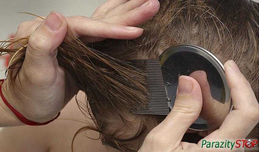Эффективные народные средства от вшей и гнид