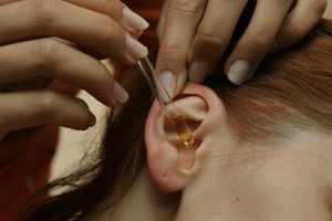 Народные способы лечения ушного клеща у человека