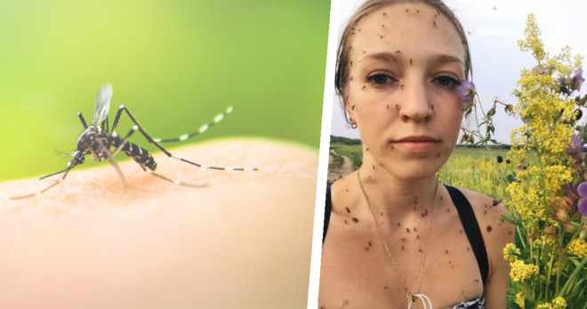 Комары на девушке